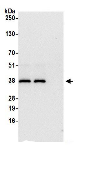 DCPS Antibody