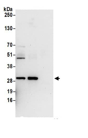 UCK2 Antibody