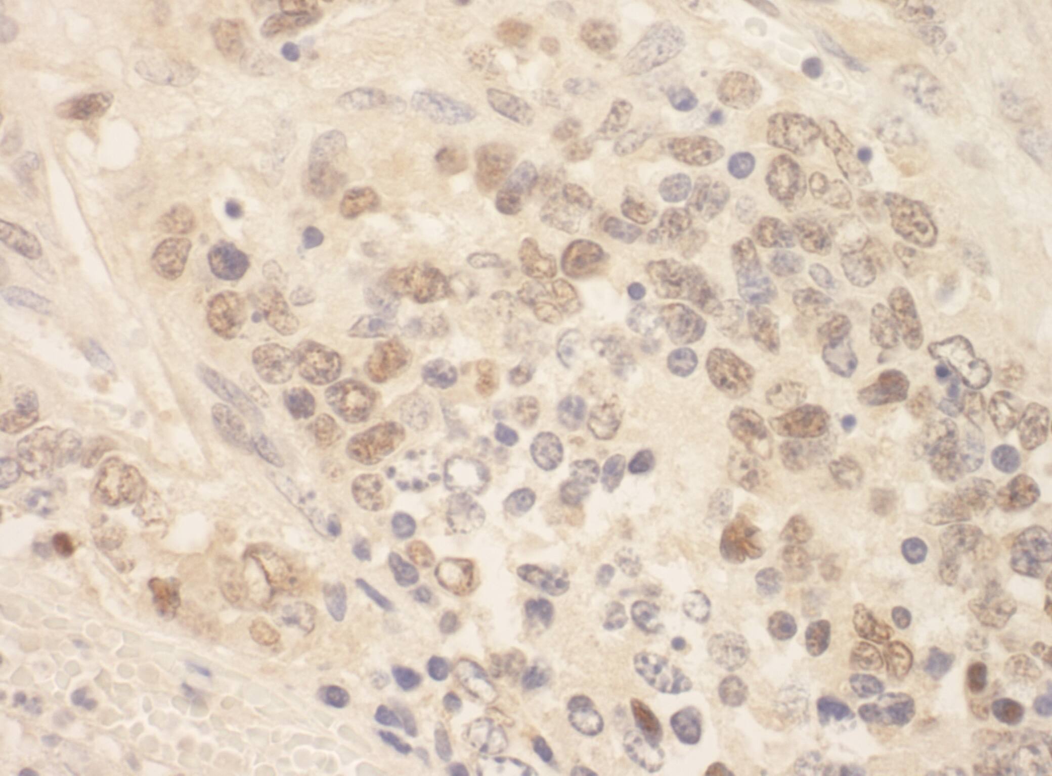 ZEB2 Antibody