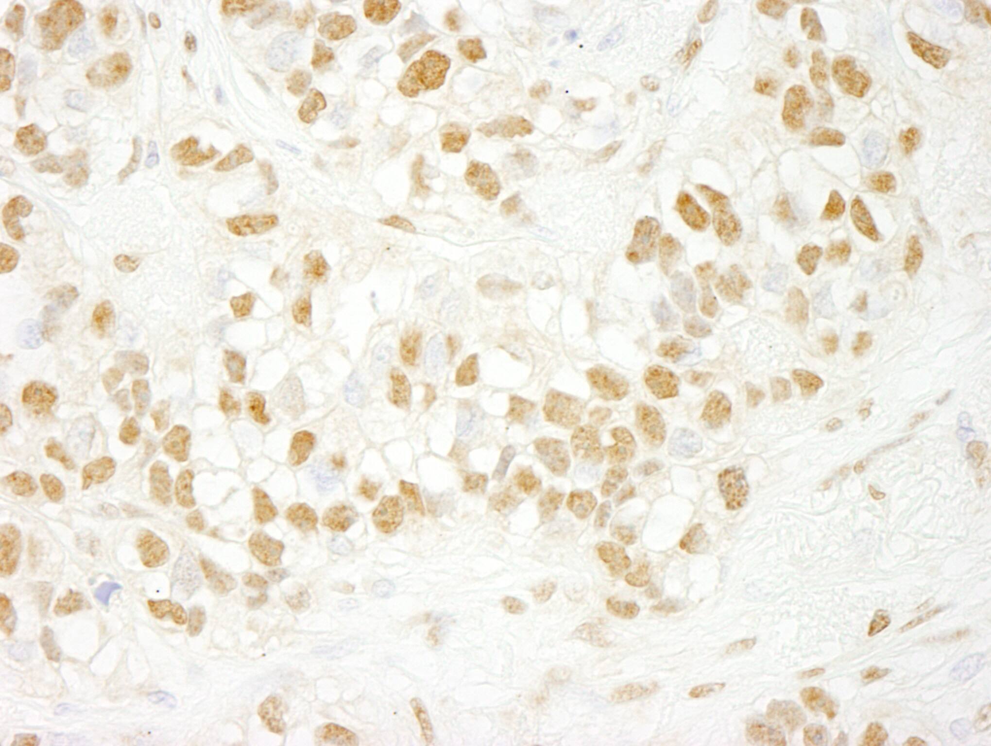 CDC5L Antibody