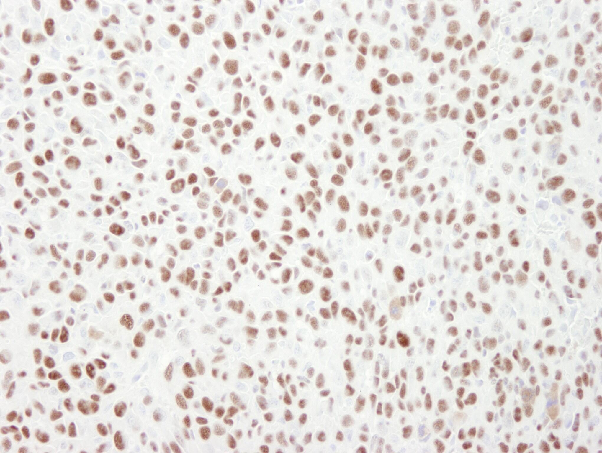 MCM6 Antibody