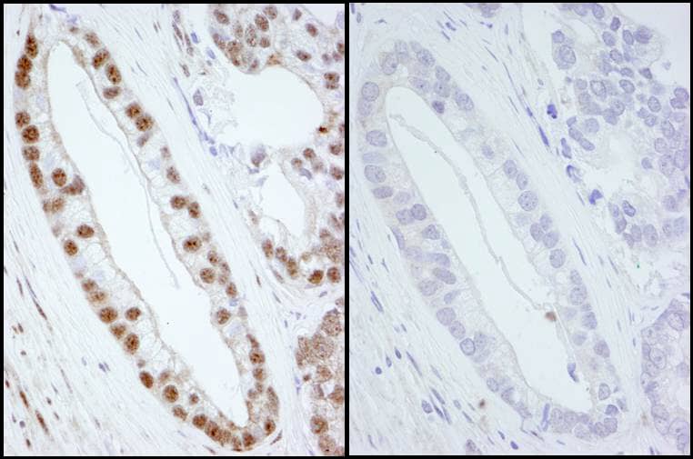 SMC1 Antibody