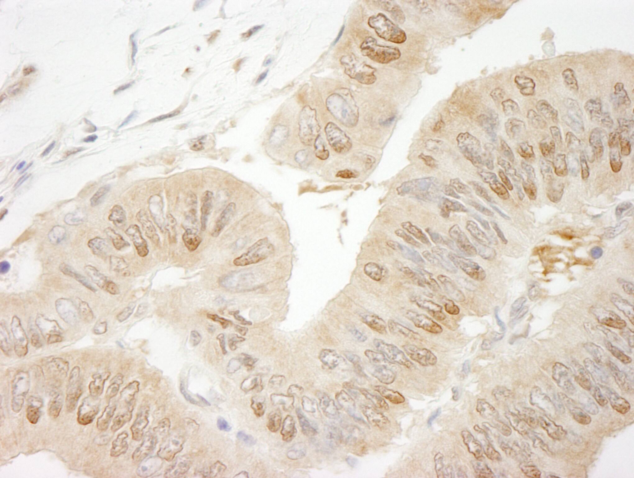 RanBP1 Antibody