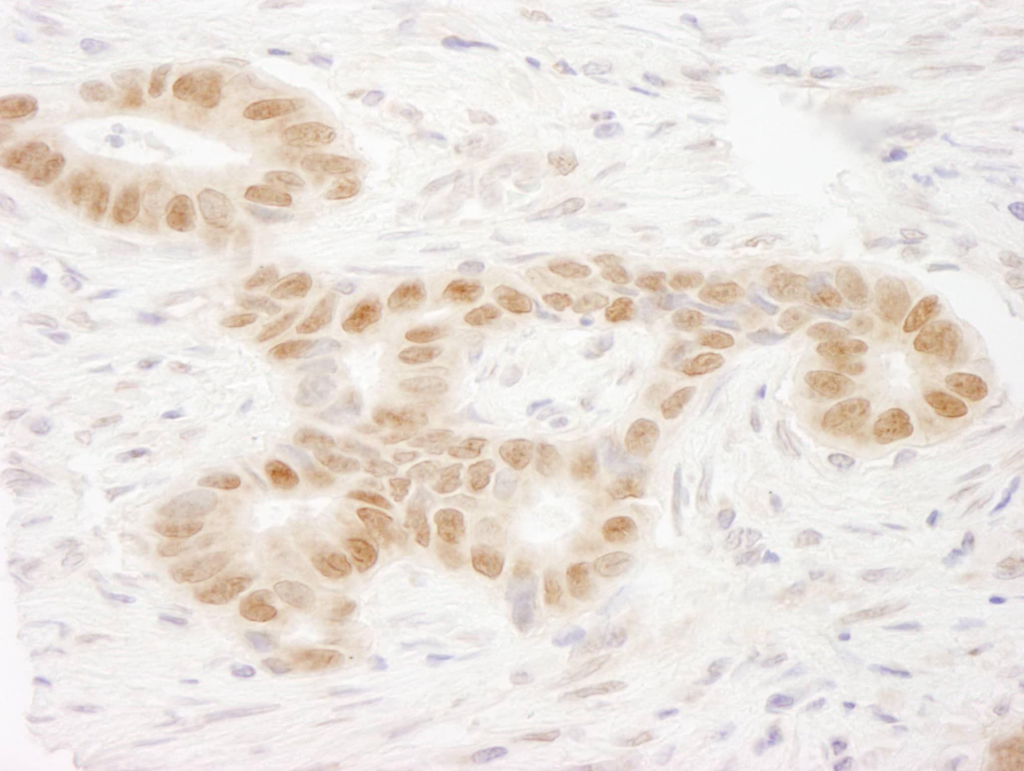 MAML2 Antibody