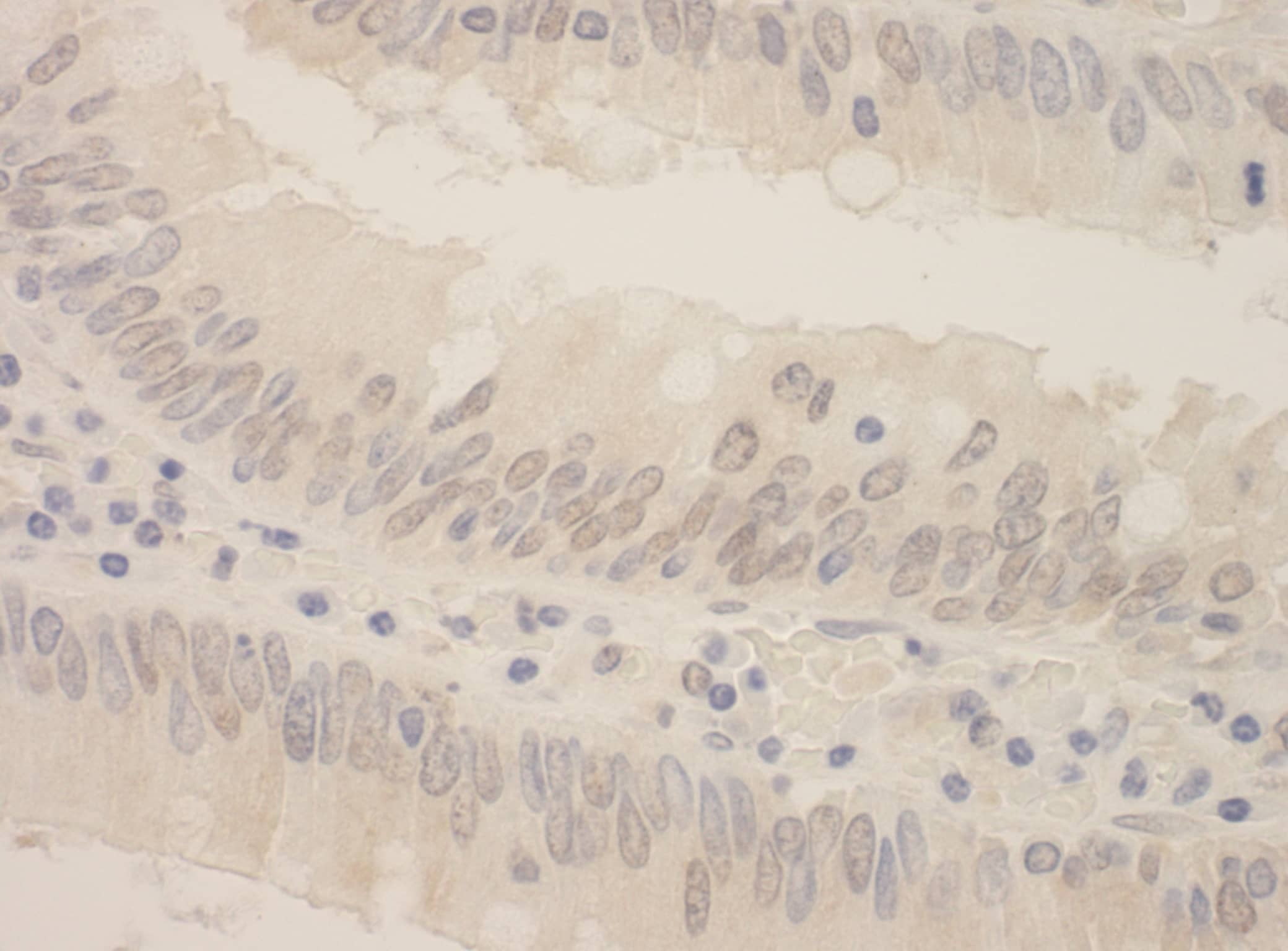 SRPK2 Antibody