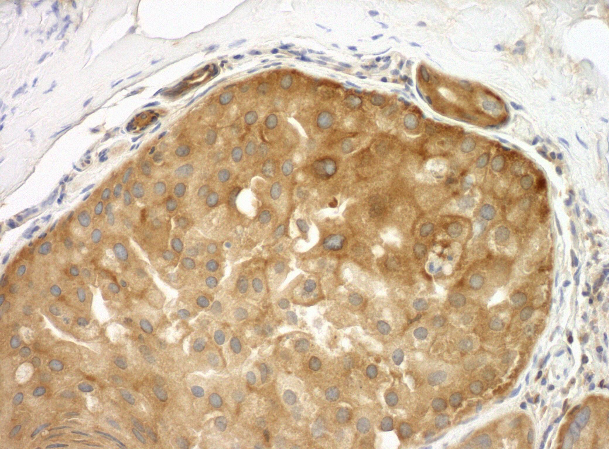 Septin-9 Antibody