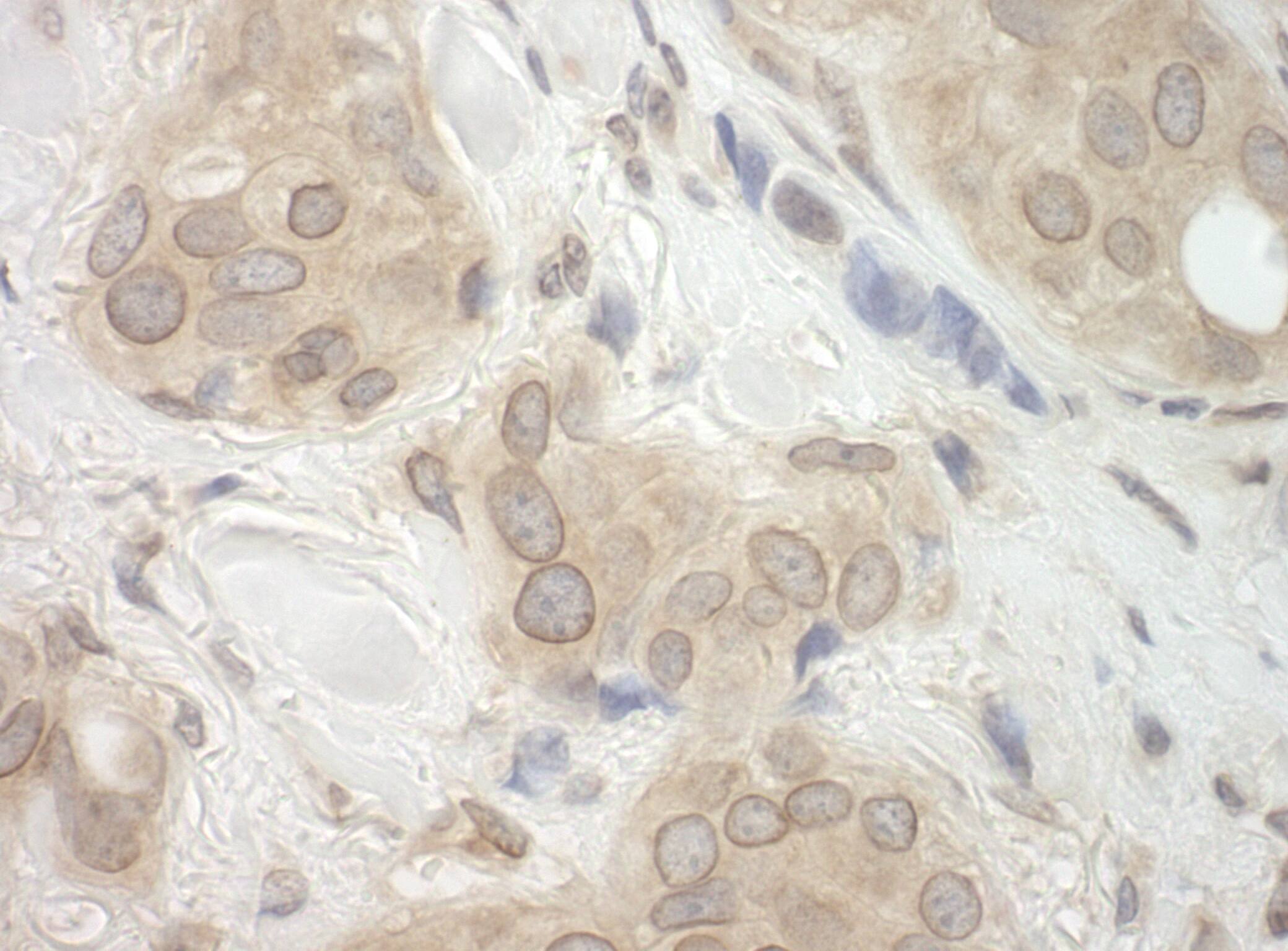 CASC3 Antibody