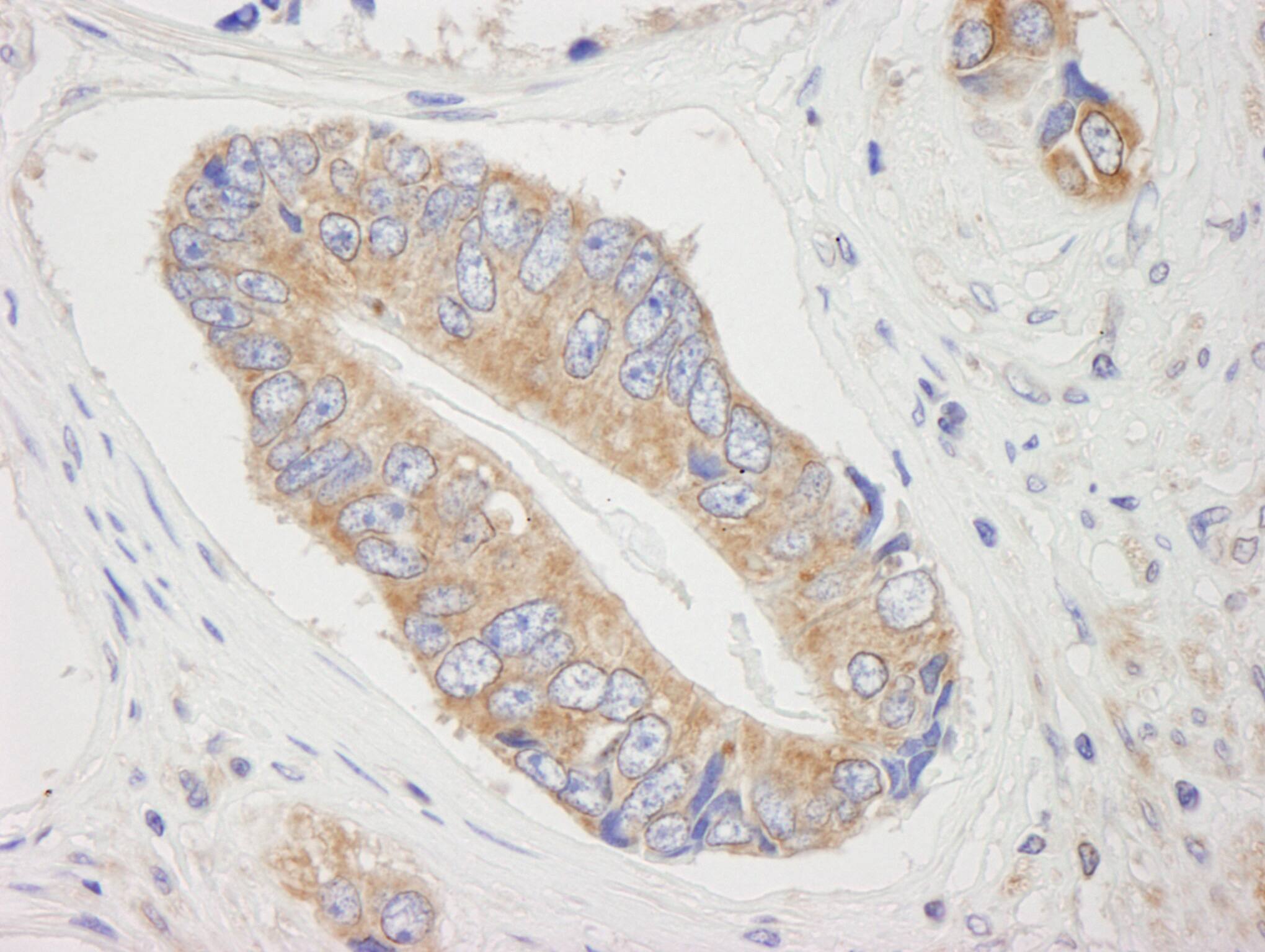 eIF4ENIF1 Antibody