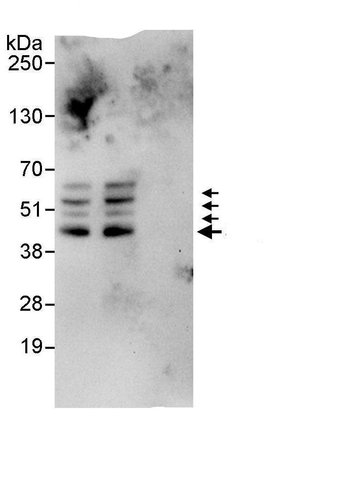 Sphingosine Kinase 1/SPHK1 Antibody