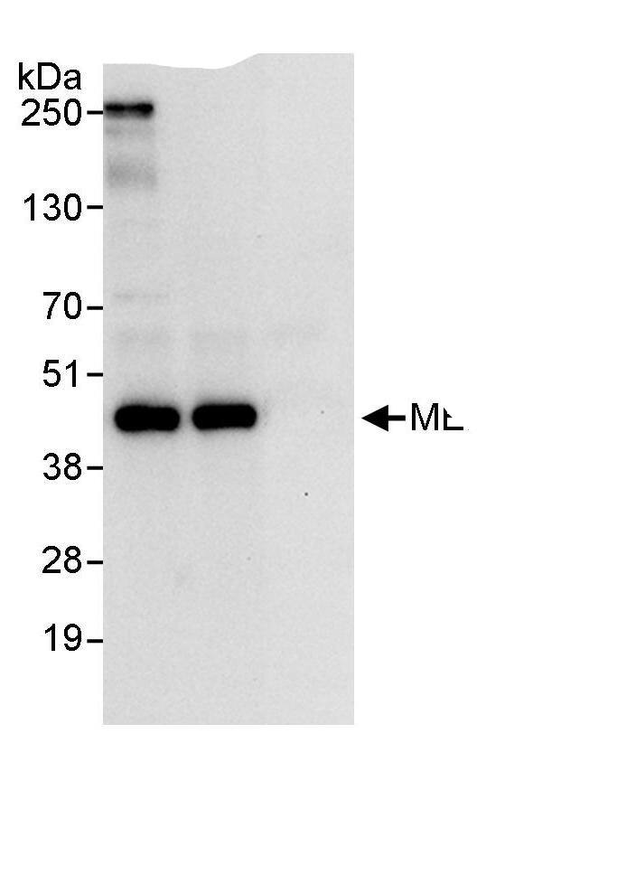 MERIT40/HSPC142 Antibody