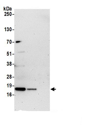 TMEM85 Antibody