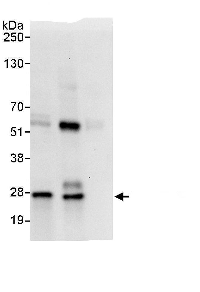 CCDC28A Antibody