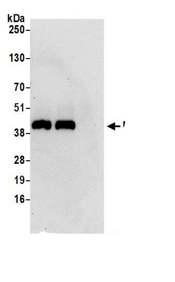 Mannose Phosphate Isomerase Antibody