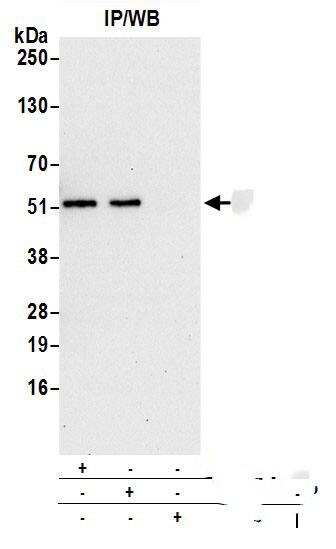 Cytosol Nonspecific Dipeptidase (CNDP2)/CPGL Antibody