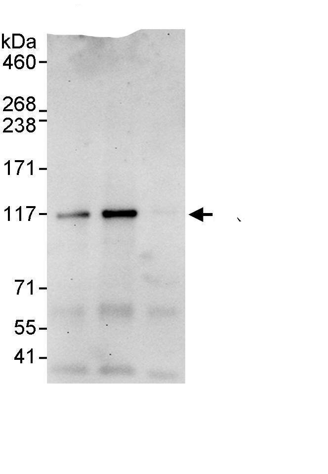 ANKRD52 Antibody