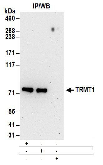 TRM1 Antibody