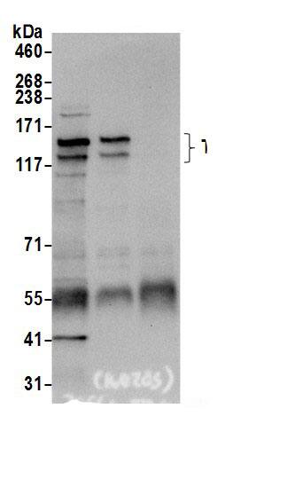 TBC1D1 Antibody