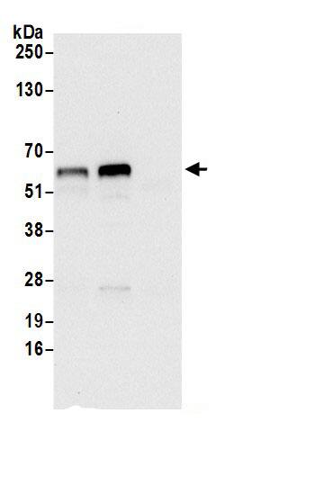 Asparagine synthetase Antibody