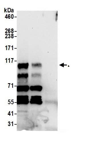 ZC3H7B Antibody