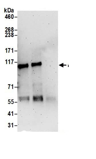 PLD1 Antibody