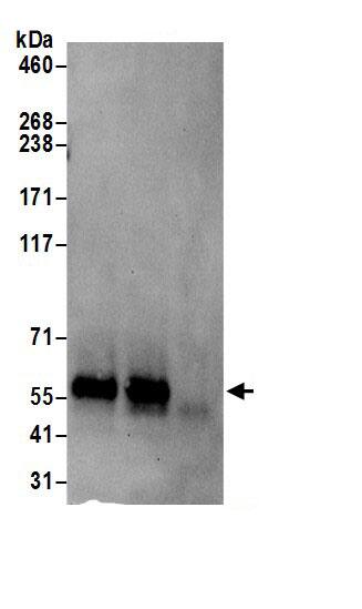 Lipolysis Stimulated Lipoprotein Receptor Antibody