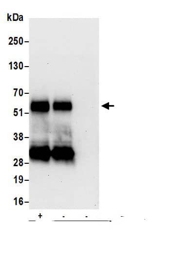 Lymphotoxin beta R/TNFRSF3 Antibody