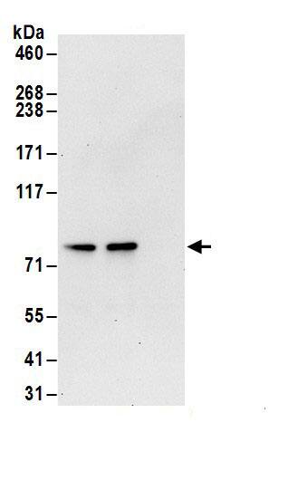 Transglutaminase 2/TGM2 Antibody