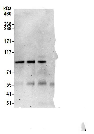 PPP1R18 Antibody