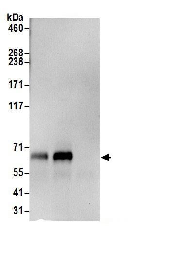 MTMR6 Antibody