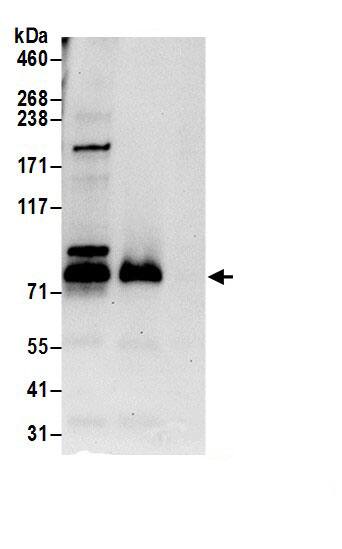 SDAD1 Antibody