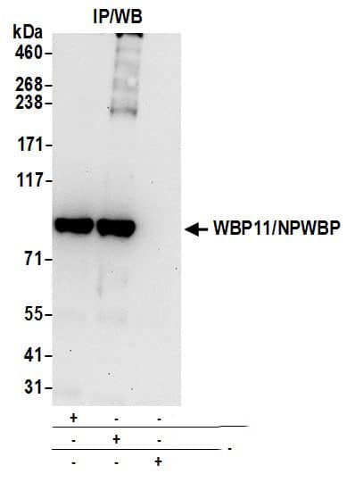 WBP11 Antibody