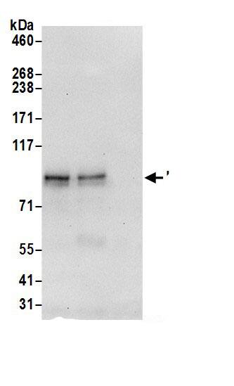 LZTS2 Antibody