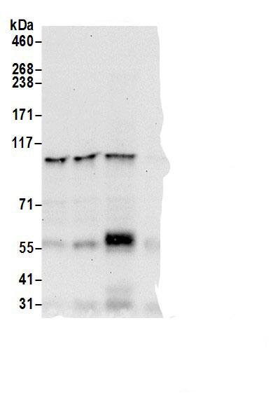 NEDD4 Antibody