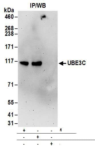 UBE3C Antibody