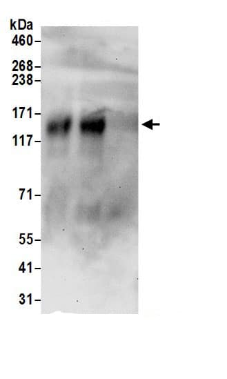 KCC3/SLC12A6 Antibody