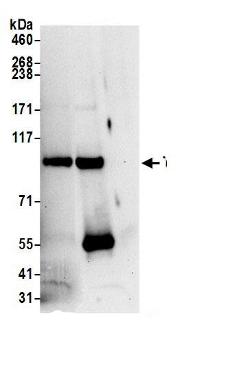 TSR1 Antibody