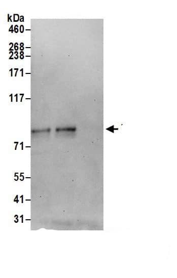 TMTC3 Antibody