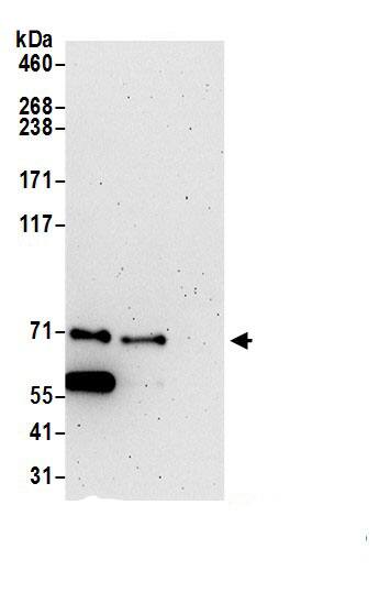 TBCK Antibody