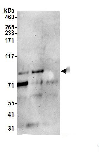 TTC7A Antibody