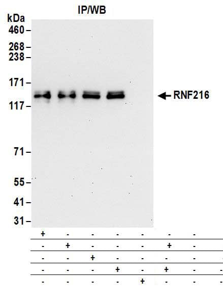 TRIAD3 Antibody