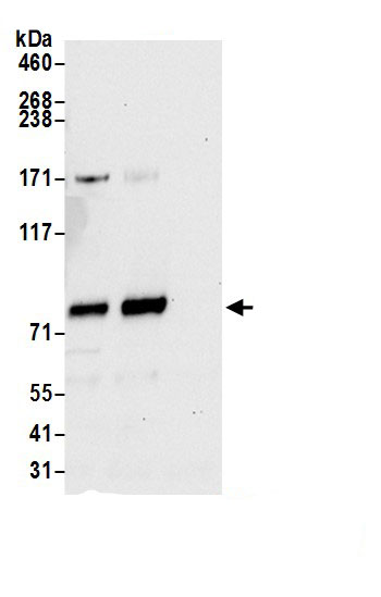 TMTC3 Antibody