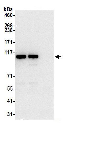 PITRM1 Antibody
