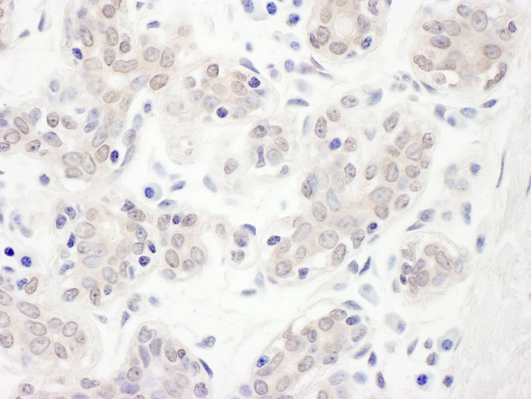 CBLL1 Antibody