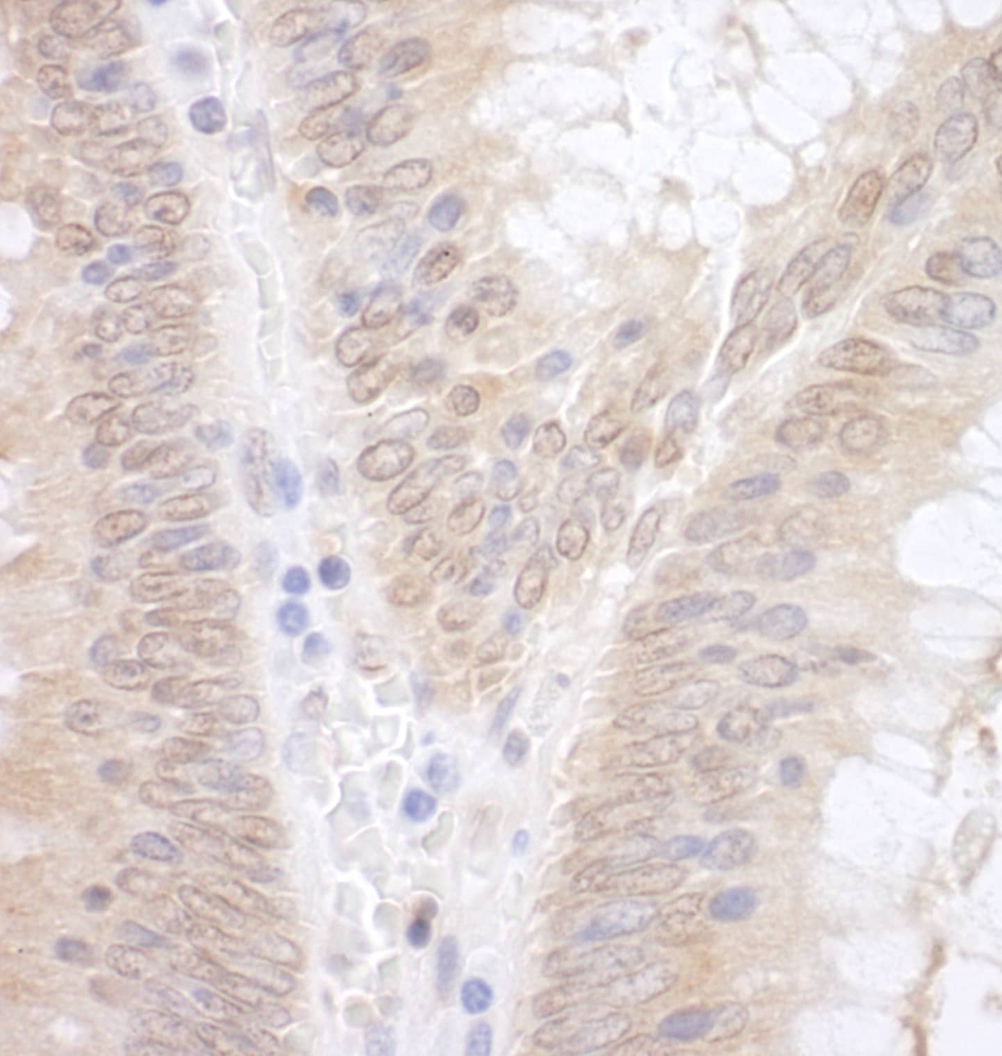 EAF2 Antibody