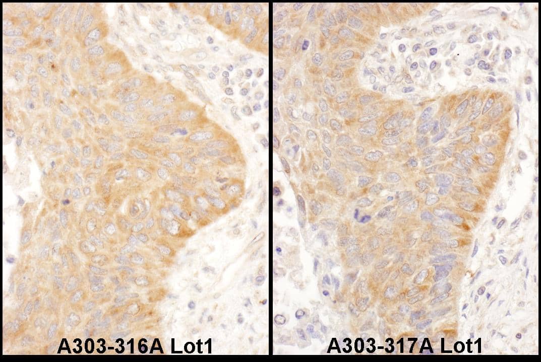 IMP2/IGF2BP2 Antibody