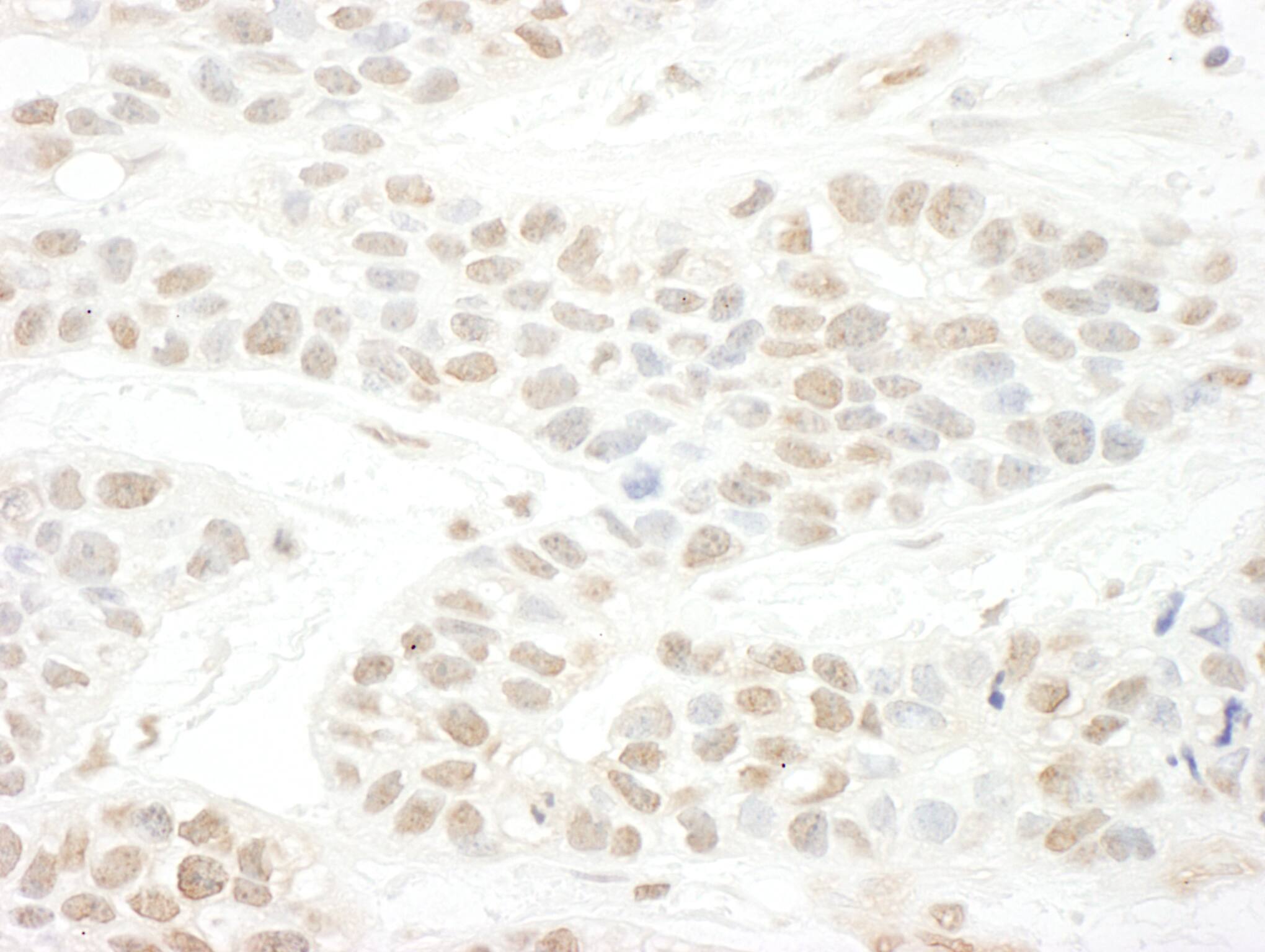 SLX4 Antibody