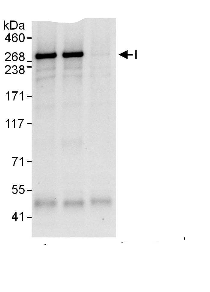 Desmoplakin Antibody