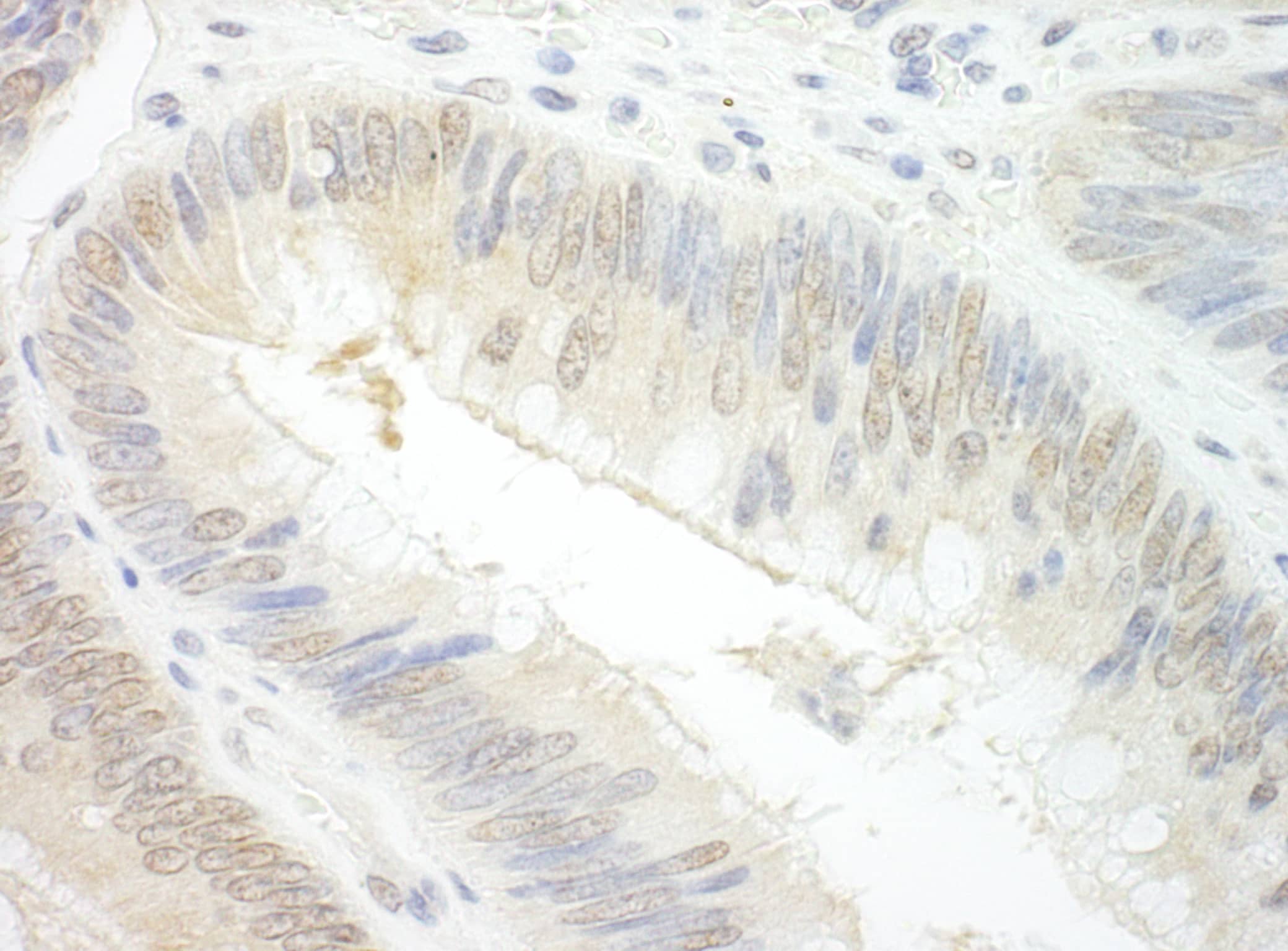 EAF2 Antibody