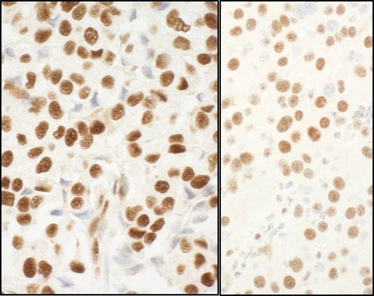 NPM1 Antibody