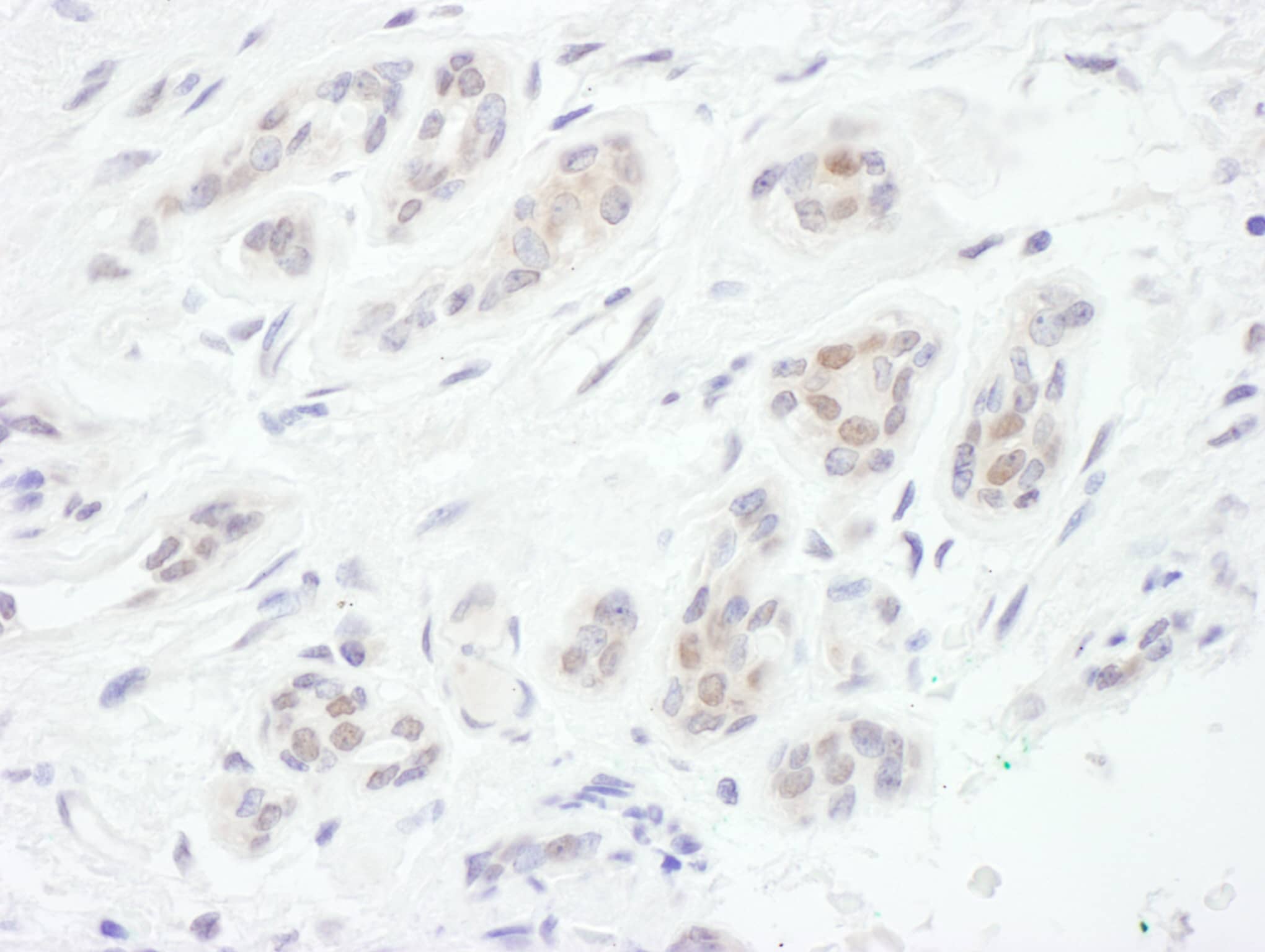 FoxC1 Antibody